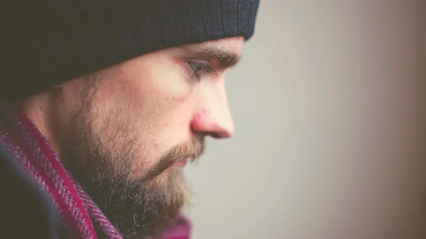 Man med mössa i profil under läkningsperioden efter ingrepp